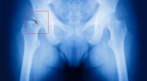 Возраст и качество: как возрастные изменения влияют на жизнь женщины 03